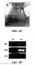 Fig. 14 - Methods of isolation, expansion and differentiation of fetal stem cells from chorionic villus, amniotic fluid, and placenta and therapeutic uses thereof