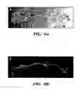 Fig. 15 - Methods of isolation, expansion and differentiation of fetal stem cells from chorionic villus, amniotic fluid, and placenta and therapeutic uses thereof