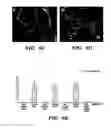 Fig. 16 - Methods of isolation, expansion and differentiation of fetal stem cells from chorionic villus, amniotic fluid, and placenta and therapeutic uses thereof