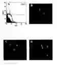 Fig. 01 - Methods of isolation, expansion and differentiation of fetal stem cells from chorionic villus, amniotic fluid, and placenta and therapeutic uses thereof
