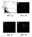 Fig. 02 - Methods of isolation, expansion and differentiation of fetal stem cells from chorionic villus, amniotic fluid, and placenta and therapeutic uses thereof