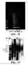 Fig. 04 - Methods of isolation, expansion and differentiation of fetal stem cells from chorionic villus, amniotic fluid, and placenta and therapeutic uses thereof