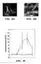 Fig. 05 - Methods of isolation, expansion and differentiation of fetal stem cells from chorionic villus, amniotic fluid, and placenta and therapeutic uses thereof