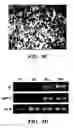 Fig. 10 - Methods of isolation, expansion and differentiation of fetal stem cells from chorionic villus, amniotic fluid, and placenta and therapeutic uses thereof