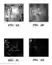 Fig. 11 - Methods of isolation, expansion and differentiation of fetal stem cells from chorionic villus, amniotic fluid, and placenta and therapeutic uses thereof