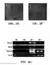 Fig. 12 - Methods of isolation, expansion and differentiation of fetal stem cells from chorionic villus, amniotic fluid, and placenta and therapeutic uses thereof