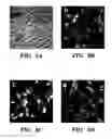 Fig. 13 - Methods of isolation, expansion and differentiation of fetal stem cells from chorionic villus, amniotic fluid, and placenta and therapeutic uses thereof