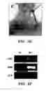 Fig. 14 - Methods of isolation, expansion and differentiation of fetal stem cells from chorionic villus, amniotic fluid, and placenta and therapeutic uses thereof