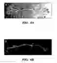 Fig. 15 - Methods of isolation, expansion and differentiation of fetal stem cells from chorionic villus, amniotic fluid, and placenta and therapeutic uses thereof
