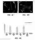 Fig. 16 - Methods of isolation, expansion and differentiation of fetal stem cells from chorionic villus, amniotic fluid, and placenta and therapeutic uses thereof