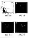 Fig. 02 - Methods of isolation, expansion and differentiation of fetal stem cells from chorionic villus, amniotic fluid, and placenta and therapeutic uses thereof