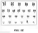 Fig. 03 - Methods of isolation, expansion and differentiation of fetal stem cells from chorionic villus, amniotic fluid, and placenta and therapeutic uses thereof