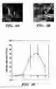 Fig. 05 - Methods of isolation, expansion and differentiation of fetal stem cells from chorionic villus, amniotic fluid, and placenta and therapeutic uses thereof