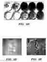 Fig. 06 - Methods of isolation, expansion and differentiation of fetal stem cells from chorionic villus, amniotic fluid, and placenta and therapeutic uses thereof