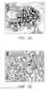 Fig. 09 - Methods of isolation, expansion and differentiation of fetal stem cells from chorionic villus, amniotic fluid, and placenta and therapeutic uses thereof