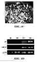 Fig. 10 - Methods of isolation, expansion and differentiation of fetal stem cells from chorionic villus, amniotic fluid, and placenta and therapeutic uses thereof