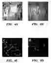 Fig. 11 - Methods of isolation, expansion and differentiation of fetal stem cells from chorionic villus, amniotic fluid, and placenta and therapeutic uses thereof