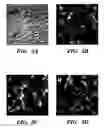 Fig. 13 - Methods of isolation, expansion and differentiation of fetal stem cells from chorionic villus, amniotic fluid, and placenta and therapeutic uses thereof