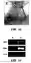 Fig. 14 - Methods of isolation, expansion and differentiation of fetal stem cells from chorionic villus, amniotic fluid, and placenta and therapeutic uses thereof