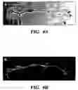 Fig. 15 - Methods of isolation, expansion and differentiation of fetal stem cells from chorionic villus, amniotic fluid, and placenta and therapeutic uses thereof