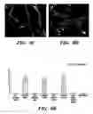 Fig. 16 - Methods of isolation, expansion and differentiation of fetal stem cells from chorionic villus, amniotic fluid, and placenta and therapeutic uses thereof