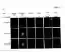 Fig. 12 - Hox11+, CD45− cells and methods of organ regeneration using the same