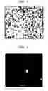Fig. 03 - Nanosphere/microsphere delivery system for the treatment of spinal cord injury