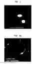 Fig. 04 - Nanosphere/microsphere delivery system for the treatment of spinal cord injury