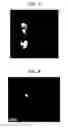 Fig. 06 - Nanosphere/microsphere delivery system for the treatment of spinal cord injury