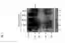 Fig. 07 - Sars coronavirus s proteins and uses thereof