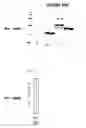 Fig. 149 - Immunisation against Chlamydia pneumoniae