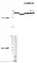 Fig. 67 - Immunisation against Chlamydia pneumoniae