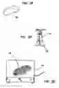 Fig. 03 - Apparatus and method for preventing adhesions between an implant and surrounding tissues