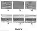 Fig. 03 - Microporous articles comprising biodegradable medical polymers, method of preparation thereof and method of use thereof