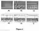 Fig. 04 - Microporous articles comprising biodegradable medical polymers, method of preparation thereof and method of use thereof