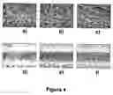 Fig. 05 - Microporous articles comprising biodegradable medical polymers, method of preparation thereof and method of use thereof
