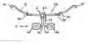 Fig. 01 - Functional orthodontic appliance with an extraoral device