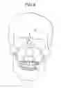 Fig. 10 - Denture base, method of preparing denture bases, and a denture base component