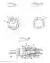 Fig. 02 - Implant arrangement with an internal socket for a turning tool