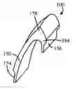 Fig. 01 - Modular tooth veneer