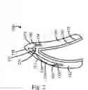 Fig. 03 - Modular tooth veneer