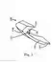 Fig. 04 - Modular tooth veneer