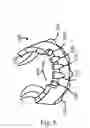 Fig. 07 - Modular tooth veneer