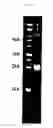 Fig. 12 - Support, printed material and reagent kit having enzyme fixed thereon, method for preparing the support, method of storing enzyme and method for restoration enzymes