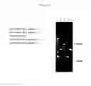 Fig. 14 - Support, printed material and reagent kit having enzyme fixed thereon, method for preparing the support, method of storing enzyme and method for restoration enzymes