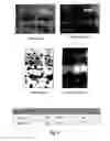 Fig. 28 - Biomarker for determining predisposition and/or prognosis of hepatocellular carcinoma