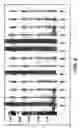 Fig. 07 - Achaete-Scute Like-2 Polypeptides and Encoding Nucleic Acids and Methods for the Diagnosis and Treatment of Tumor