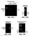 Fig. 16 - Achaete-Scute Like-2 Polypeptides and Encoding Nucleic Acids and Methods for the Diagnosis and Treatment of Tumor