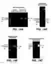 Fig. 18 - Achaete-Scute Like-2 Polypeptides and Encoding Nucleic Acids and Methods for the Diagnosis and Treatment of Tumor