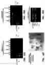 Fig. 20 - Achaete-Scute Like-2 Polypeptides and Encoding Nucleic Acids and Methods for the Diagnosis and Treatment of Tumor